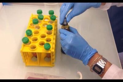 Manos con guantes azules manipulando un frasco junto a un rack amarillo con tubos de tapón verde para un cariotipo sucedido.