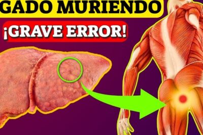 Ilustración de un hígado con aspecto enfermo y una flecha que indica dolor corporal por dano hepatico.