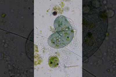 Descubre que comen los nematodos una guia completa, micrografía que muestra microorganismos verdes, células, burbujas y partículas orgánicas visibles al microscopio