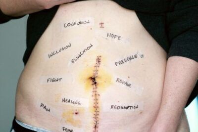 Torso con cicatriz vertical, vendajes y palabras escritas alrededor, descubre significado acuario personalidad