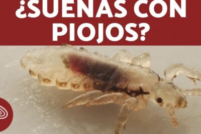Primer plano de un piojo en la cabeza muestra detalles del parásito descubre todo lo que necesitas saber sobre que significa tener piojos