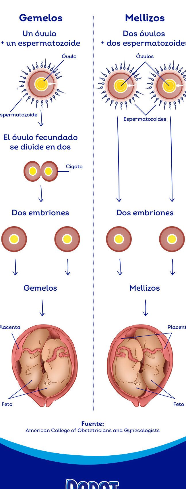 Infografía comparativa de la formación de gemelos y mellizos, estoy embarazada y vomito sangre descubre las posibles causas