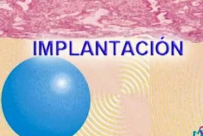 Esquema que muestra implantacion embrion con esfera azul frente a una capa de tejido endometrial