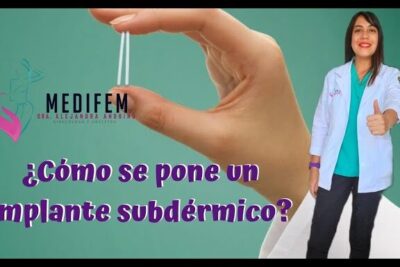 Mano sosteniendo un implante subdérmico y profesional de salud con bata mostrando aprobación, jadelle mueve