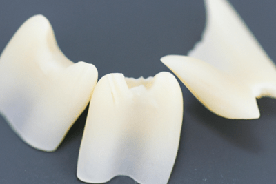 Coronas y carillas dentales sobre fondo oscuro que evocan dudas como pasta de dientes caducada es seguro usarla
