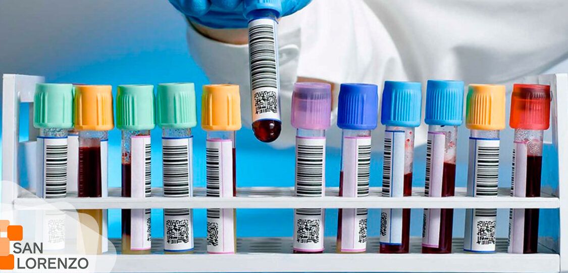 Tubo de sangre en rack con etiquetas y guante médico que indica la urea en sangre y por que es importante