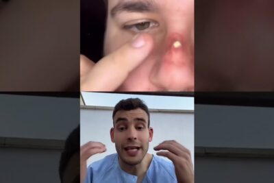 Close-up de una extracción nasal mientras un profesional en bata explica que significa 911 descubre el verdadero significado de esta clave.