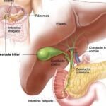 ¿Qué sucede si el páncreas no funciona correctamente? Descubre las consecuencias