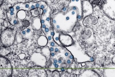 Micrografía electrónica de partículas virales resaltadas en azul, todo lo que necesitas saber sobre que significa rt en contexto científico